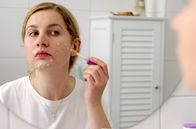 Die Ernährungs-Docs – Reinigen, pflegen, abdecken: Rund 1,5 Stunden am Tag kümmert sich Athena um ihre Haut. Das kostet nicht nur viel Zeit, sondern sie gibt auch rund 1000 Euro im Jahr für spezielle Akne-Produkte aus.