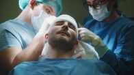NZZ Format – NZZ Format Plötzlich kahl Haartransplantation