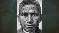 Wissenschaft extrem – In Peru greift im 19. Jahrhundert eine mysteriöse Seuche um sich.