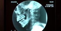 Notaufnahme Extrem – Mo, 07.11., 03:40 Uhr