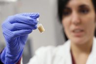 Puls – Forschungsobjekt Mikrobiom – auf Stuhlproben setzen Mikrobiologen grosse Hoffnungen für die Medizin.
