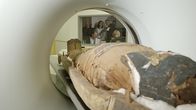 Eine kurze Geschichte über... – Untersuchung der Mumie im Computertomographen: Für die Forscher des German Mummy Projects sind die einbalsamierten Toten ganz besondere "Bio-Archive", die über das Leben und Leiden der alten Ägypter Aufschluss geben.