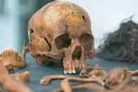NZZ Format – NZZ Format Der Knochensammler – Auf der Suche nach Gerechtigkeit im philippinischen Drogenkrieg Skelett