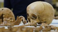 Deutschland in ... – Die Schädel und Knochen von Frauen und Kindern aus den Schachtgruben in Pömmelte zeigen Spuren von stumpfer Gewalt. Für Archäologen durchaus eine mögliche Theorie.