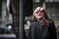 Ripper Street – Joseph Merrick (Joseph Drake)