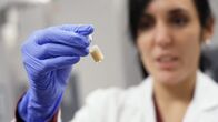 Puls – Forschungsobjekt Mikrobiom – auf Stuhlproben setzen Mikrobiologen grosse Hoffnungen für die Medizin.