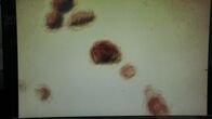Weird War Two – BEIJING - A microscopic image of a colony of plague bacteria (Yersinia pestis) which was cultivated by the researchers of Japan's Unit 731 to create the ultimate germ weapon.