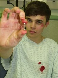 Notaufnahme Extrem – Robbie Powell, bleeding nipple.