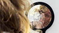 Puls – Puls Verzerrtes Körperbild – Die Angst, hässlich zu sein Menschen mit einer körperdysmorphen Störung ertragen ihr eigens Spiegelbild kaum. Copyright: SRF