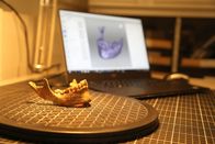 Kriegerinnen der Wikinger – Jaw reconstruction at Durham.