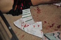 Unfall, Selbstmord oder Mord – Mo, 08.01., 01:55 Uhr