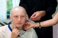Das Mädchen mit den langen Haaren – Damit die PerĂĽcke richtig sitzt, muss Anouks Kopf ganz genau abgemessen und ein Abdruck gemacht werden.