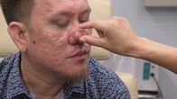 Dr. Pimple Popper – The patient was examined by Dr. Lee