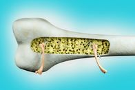 Quarks – Close up of human thighs bones trying to fix osteoporosis problem inside the human thigh bone in blue background. Osteoporosis world day or retirement age or strong bones concept. 3D illustration