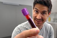 Einstein – Moderator Tobias Müller hat sein Blut für einen Test abnehmen lassen.