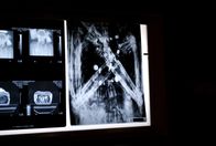 Geisterschiff im Wattenmeer – Mit Hilfe von Röntgenaufnahmen und Computertomographie versuchen heutige Wissenschaftler den Geheimnissen der oft mehrere tausend Jahre alten Mumien auf die Spur zu kommen: was war die Todesursachen? und Originale von Fälschungen zu unterscheiden.