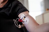 P.M. Wissen – Tattoo Elektroden im Vergleich zu herkömmlichen Elektroden