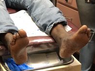 Die Fußchirurgen – A shot of the bottoms of Jefferson’s feet.