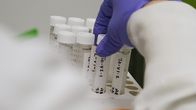 Giftige Teppiche - Gefahr durch PFAS – Gift im Blut: Die Bevölkerung in der betroffenen Region im Nordwesten Georgias und in Teilen von Alabama weist weit überdurchschnittliche Werte von PFAS im Blut auf.
