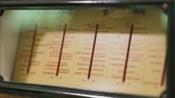 Was schätzen Sie ...? – Telefunken Röhrenradio aus dem Jahr 1933.