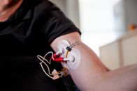 P.M. Wissen – Tattoo Elektroden im Vergleich zu herkömmlichen Elektroden