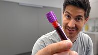 Einstein – Moderator Tobias Müller hat sein Blut für einen Test abnehmen lassen.